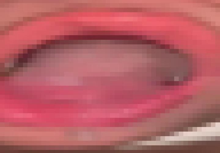 RN6mv4iP1_0zfhxB