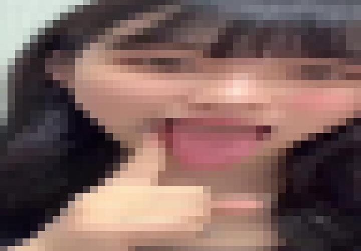 cClfvBpicGmdCfq8