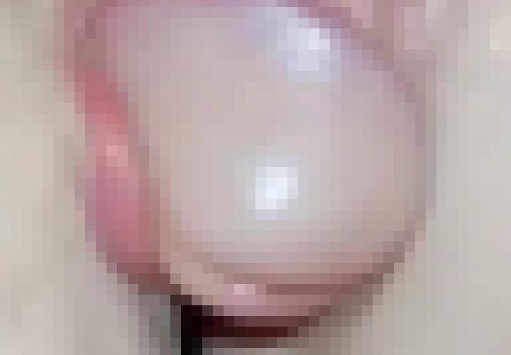dRNhdueEplWfEsml